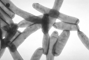 Imagen microscópica de las bacterias de la Legionella Pneumophila.  Foto: CDC Public Health Image Library (Wikipedia)